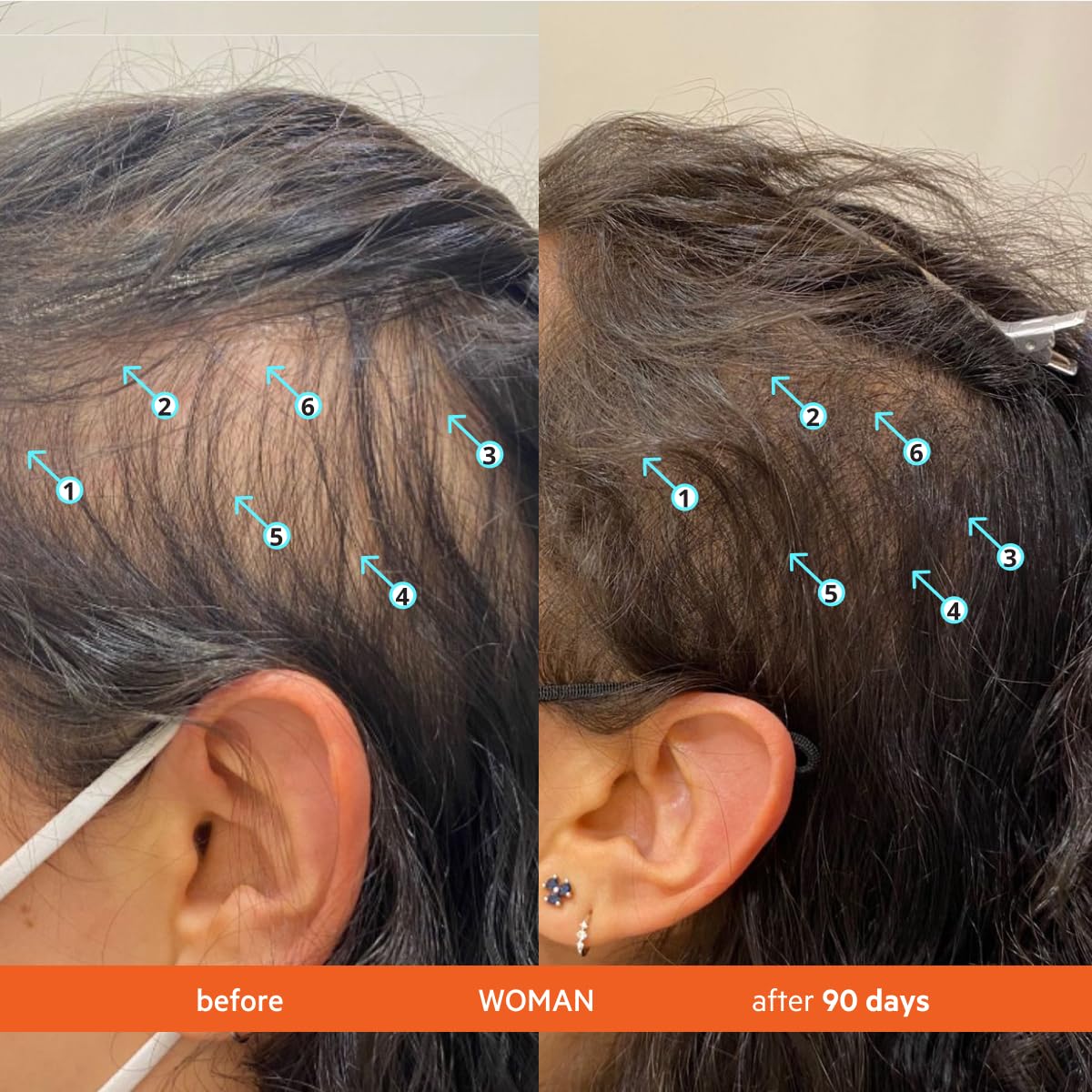 Revita Kit front view showing scalp cleanse and supplement kit