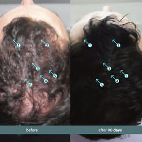 DS Labs Spectral Booster scalp coverage supports a fuller look over time