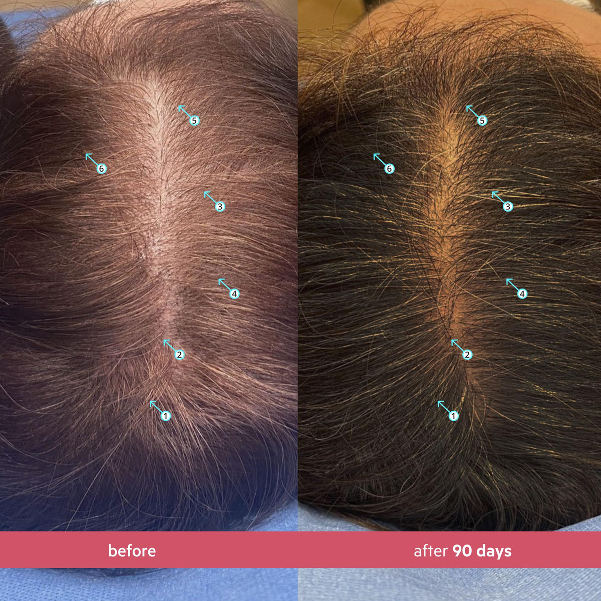 DS Laboratories Spectral Women’s Hair Density Serum pump in action enables clean, mess-free application.