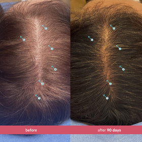 DS Laboratories Spectral Women’s Hair Density Serum pump in action enables clean, mess-free application.