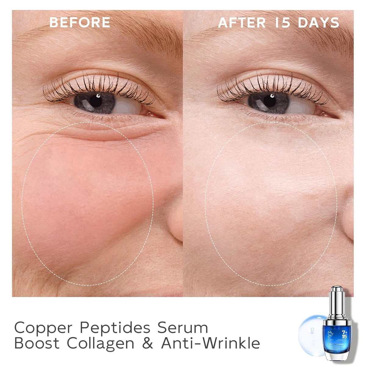 Dumie hyaluronic acid component providing deep hydration.