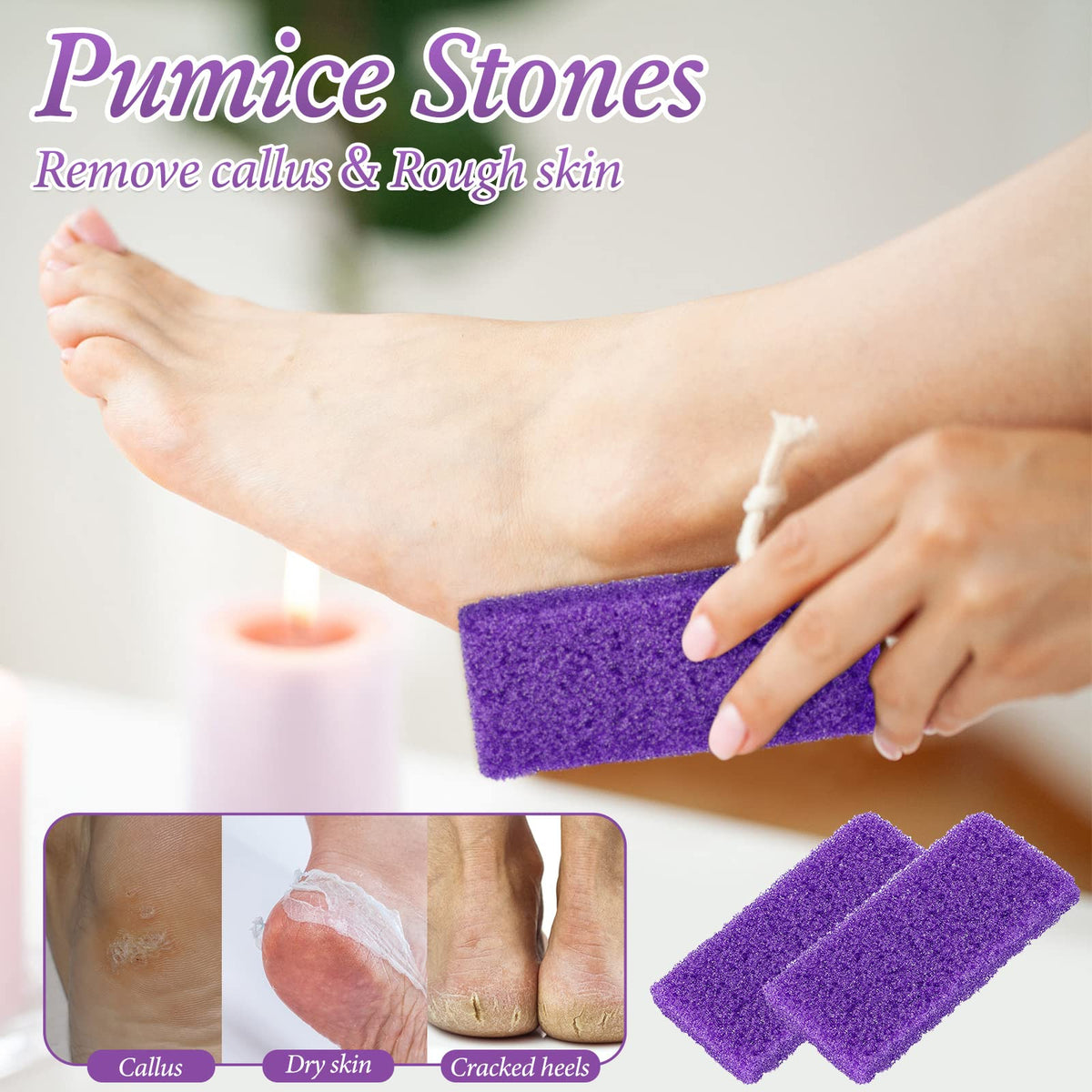 Dunzy pumice stone for home use, gentle dead skin removal
