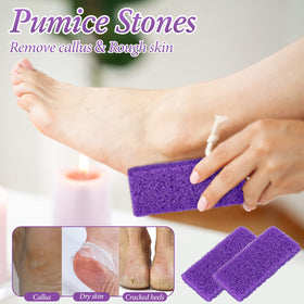 Dunzy pumice stone for home use, gentle dead skin removal