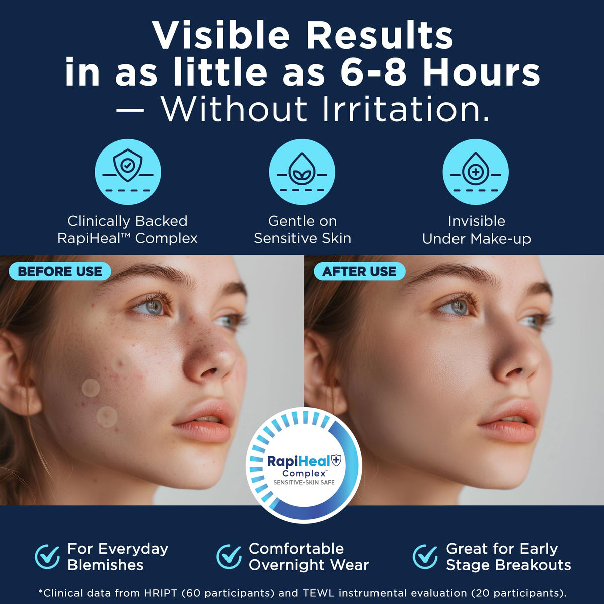 Dura Cleanse large patch size suited for cystic breakouts.