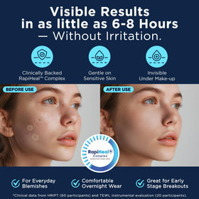 Dura Cleanse large patch size suited for cystic breakouts.