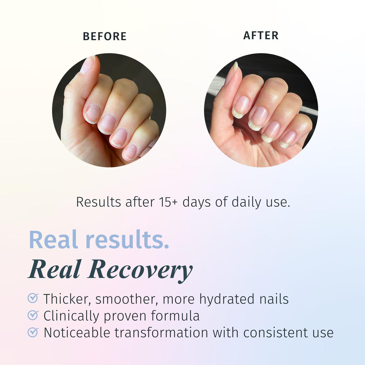 duri Rejuvacote 1 bottle side view shows protective layer for nails