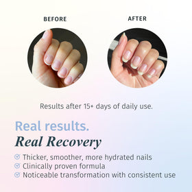 duri Rejuvacote 1 bottle side view shows protective layer for nails