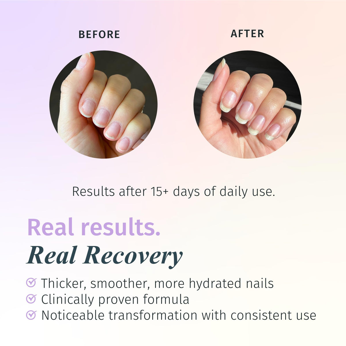Close-up of brush application on nails with Duri Rejuvacote 2.