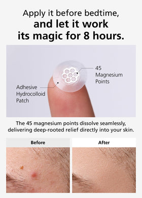 DWEasyDerm tweezers included for precise patch placement.