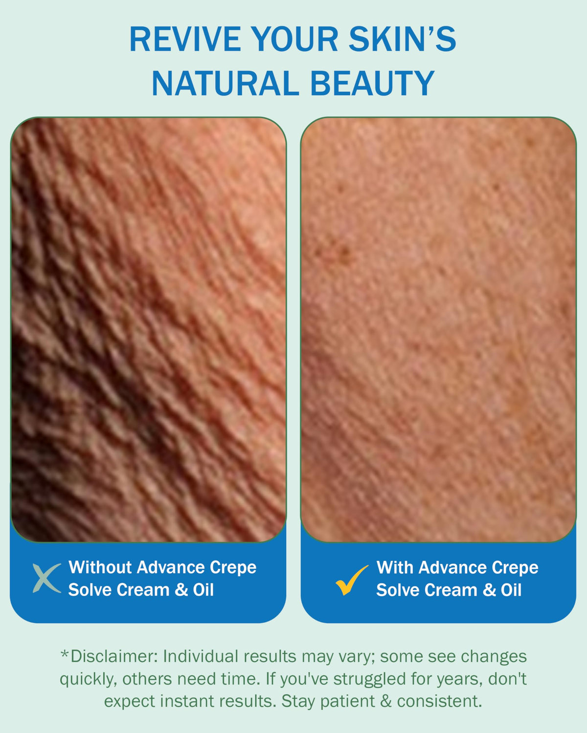 e70 Crepe Skin Erase Oil dropper conveys lightweight non-greasy feel