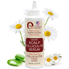 e70 folliculitis serum bottle closeup shows soothing leave-on formula for scalp