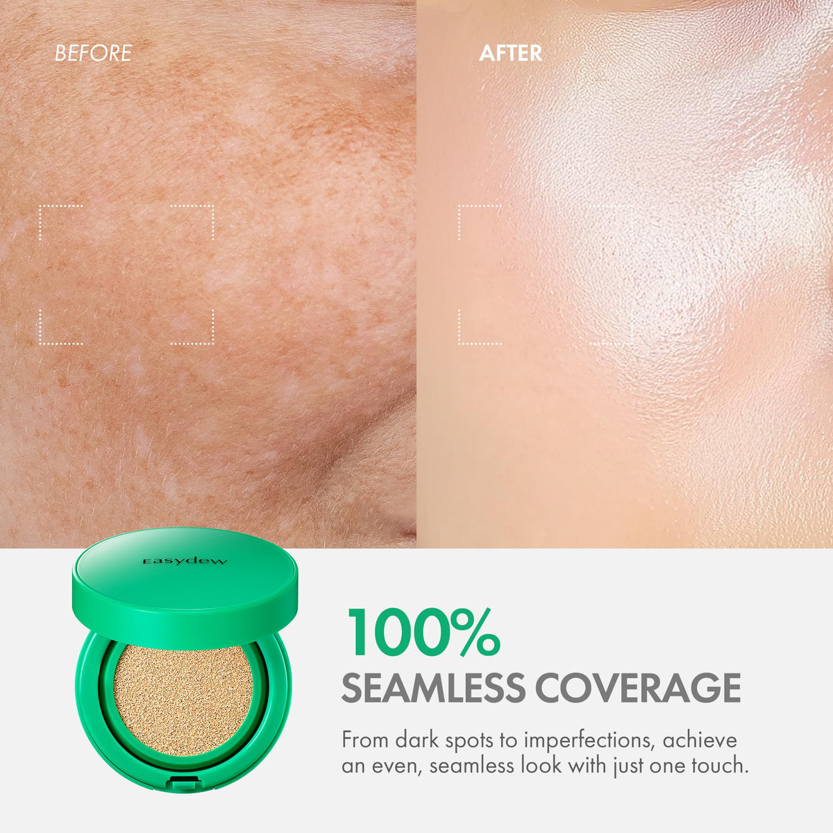 EASYDEW Mela B bottle close-up highlights EGF and hydration ingredients.