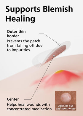 EasyDerm patch on skin shows near-invisible wear during the day.