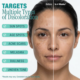 Ebanel ingredients highlight Synovea HR and actives for clearer, radiant skin.