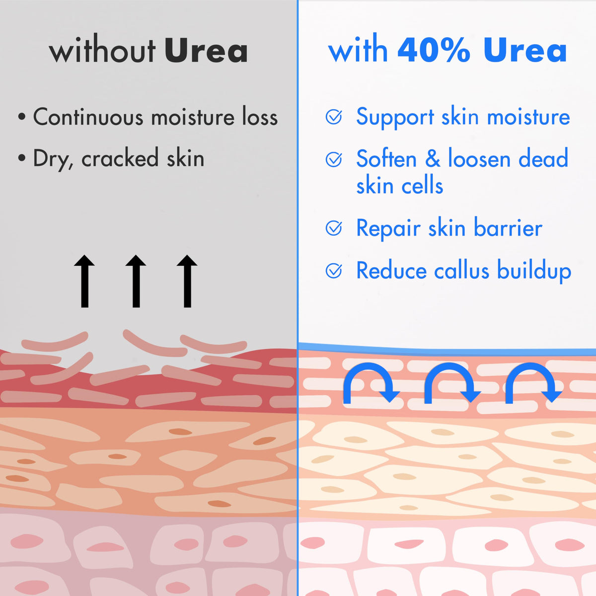 Ebanel Urea 40% tea tree oil ingredient close-up emphasizes soothing care.