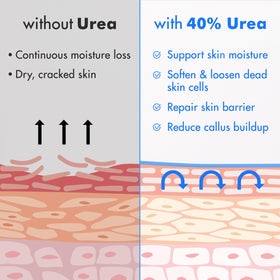 Ebanel Urea 40% tea tree oil ingredient close-up emphasizes soothing care.