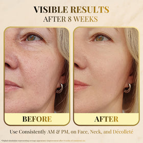 Green tea and aloe soothe and support the skin barrier