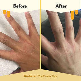 ECZEMA HONEY cruelty-free Leaping Bunny certification label on packaging