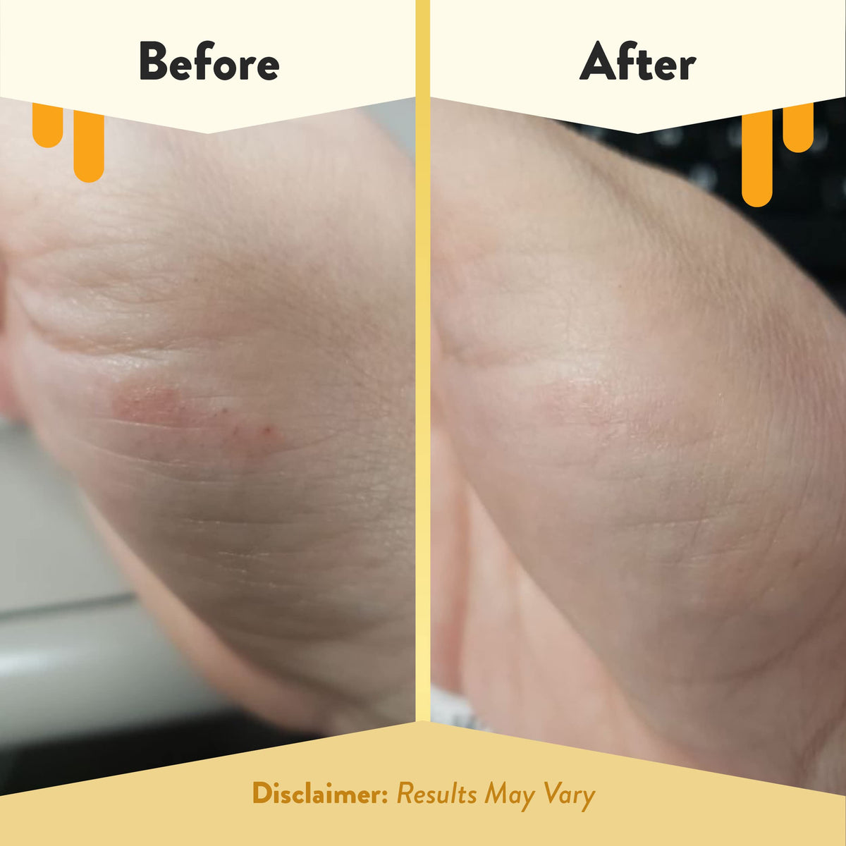 ECZEMA HONEY natural ingredients label featuring witch hazel and aloe for calm skin.