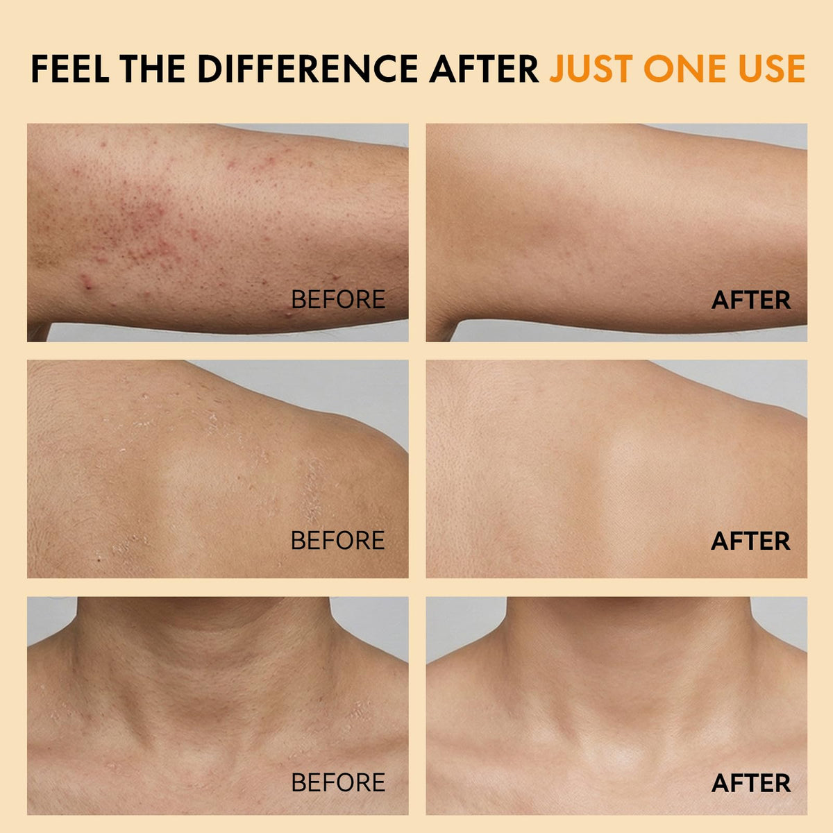 EELHOE Body spray on rough areas indicates smoothing potential.