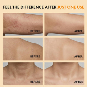 EELHOE Body spray on rough areas indicates smoothing potential.