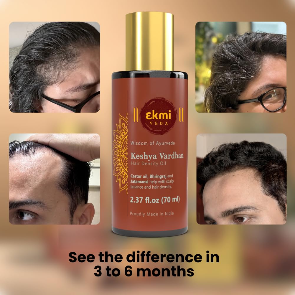 EKMIVEDA Castor Rosemary Oil in hand ready to apply.