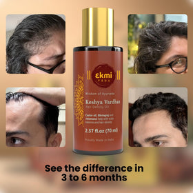 EKMIVEDA Castor Rosemary Oil in hand ready to apply.