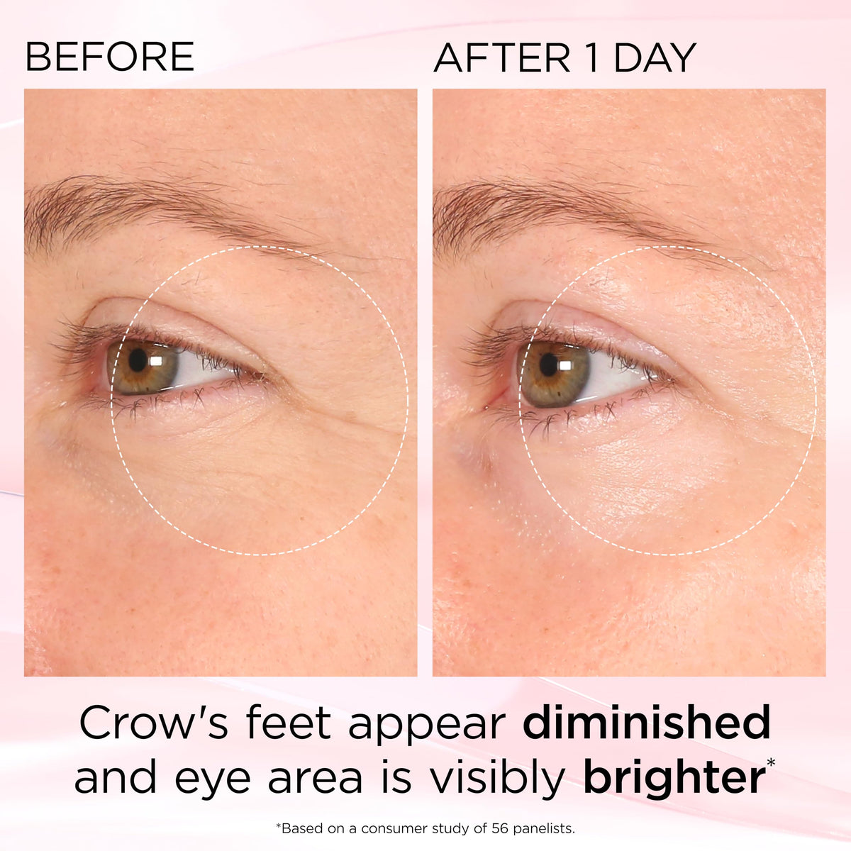 Brightening under-eye area with visible radiance