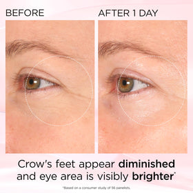 Brightening under-eye area with visible radiance