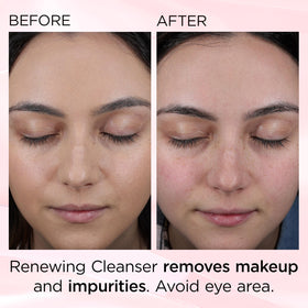 Elizabeth Arden Ceramide Skin Renewing Cleanser pore-minimizing promotes smoother-looking skin after cleansing.