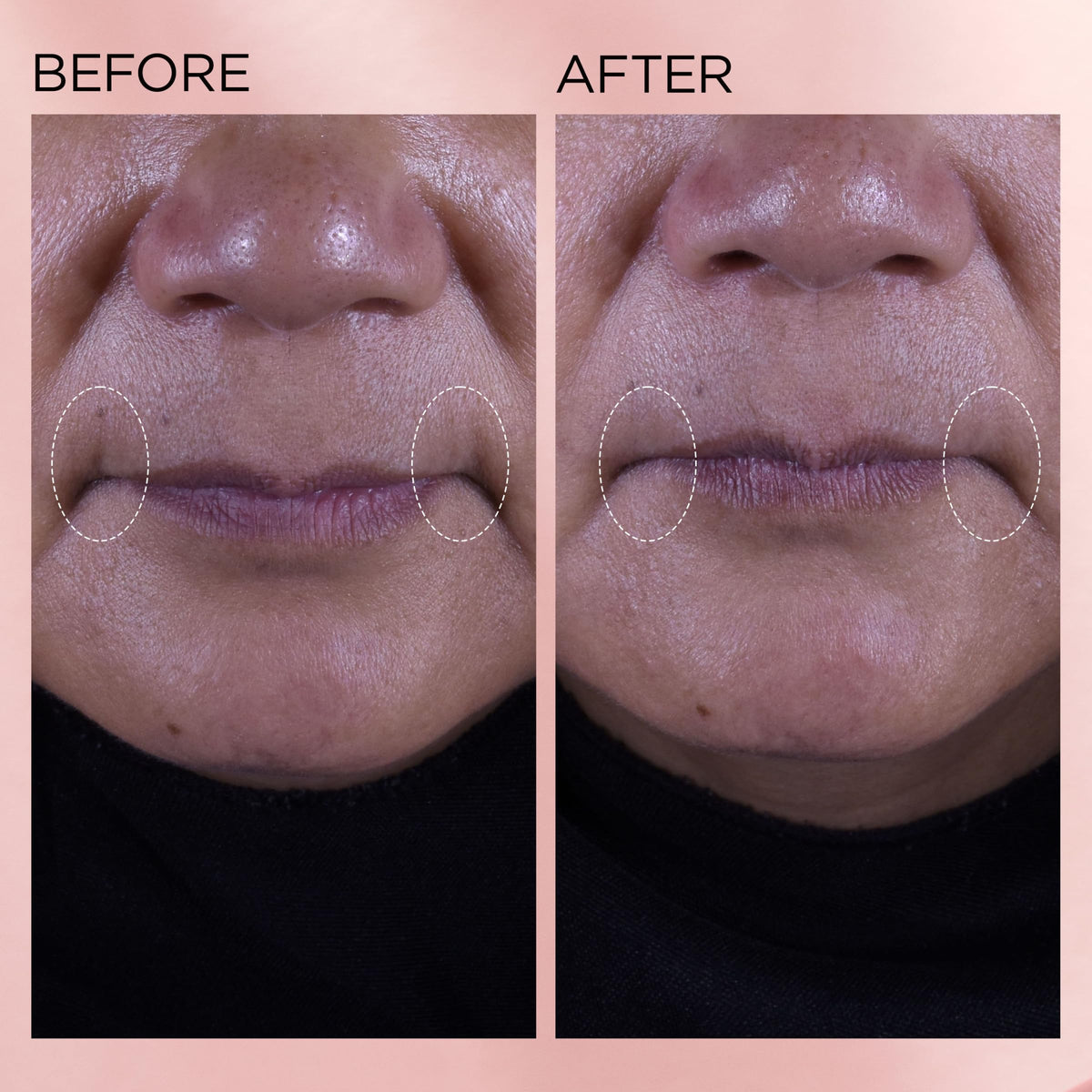 Elizabeth Arden ingredient list highlight retinol and ceramides for resilience