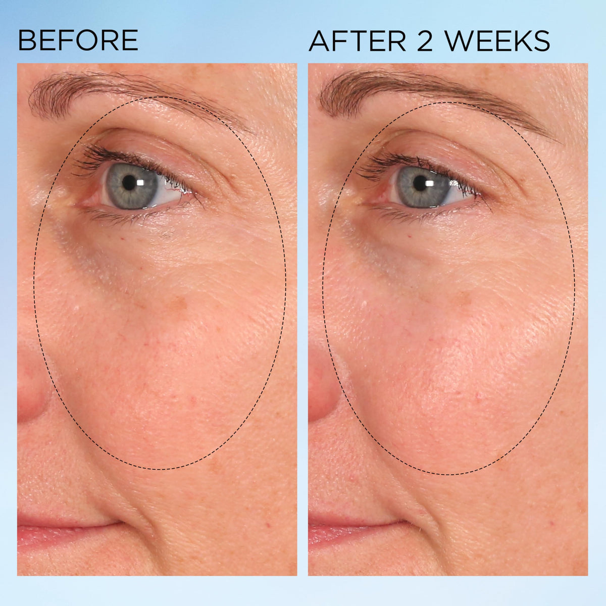 Elizabeth Arden MIX Technology visual hints at addressing pigmentation stages.