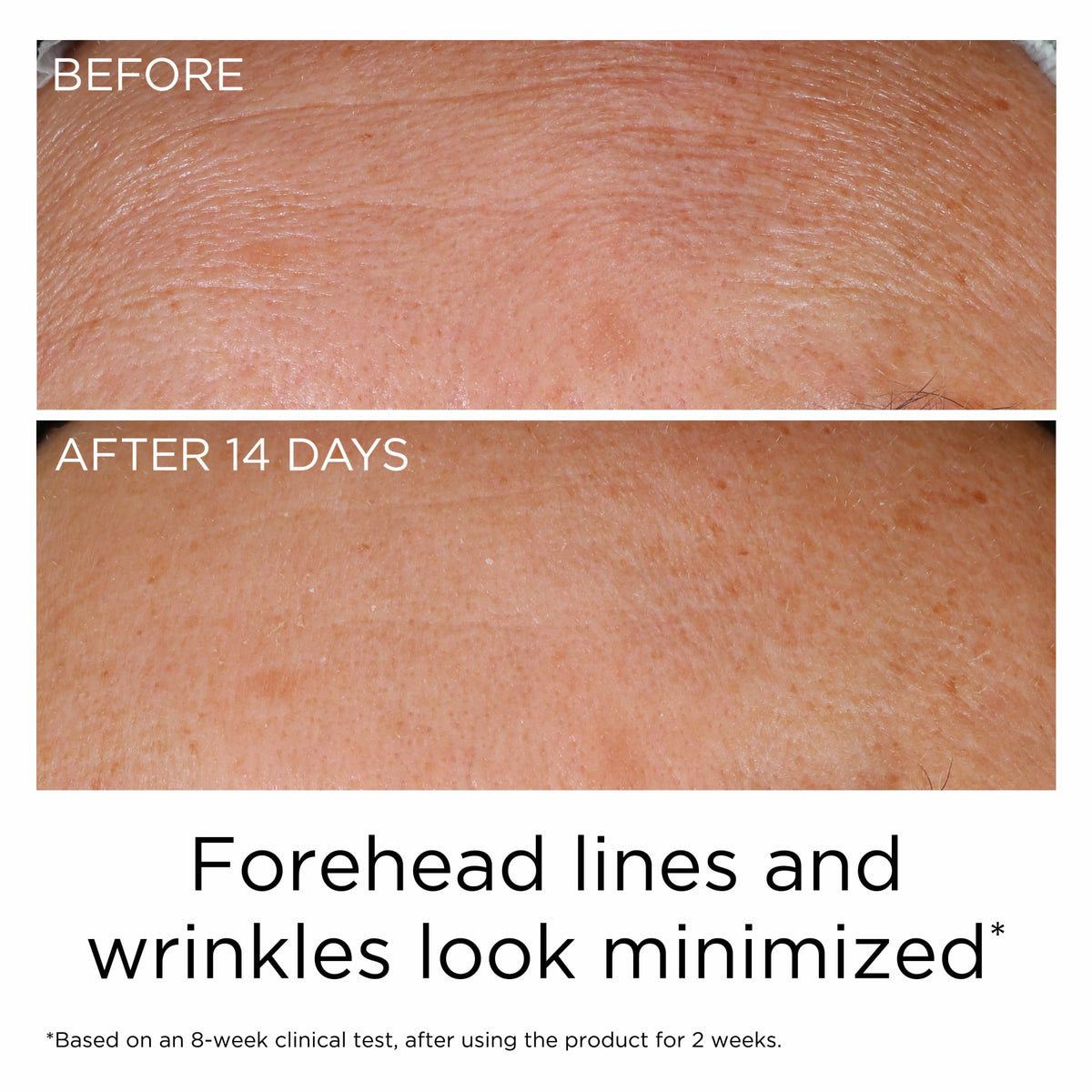 Serum drop on clean skin during morning ritual.