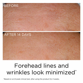 Serum drop on clean skin during morning ritual.
