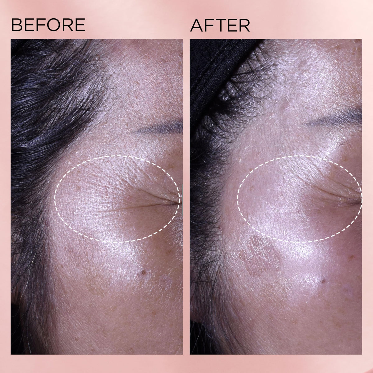 Elizabeth Arden capsule close-up suggesting gentle daily renewal potential.