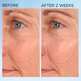 Elizabeth Arden Visible Brightening with SymWhite and SymBright for brighter, more even skin.