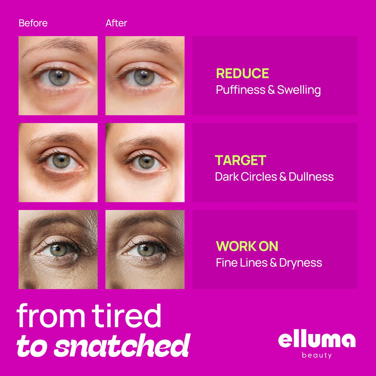 Elluma Beauty Whale Collagen Hydrating Eye Patches deliver deep hydration and suppleness
