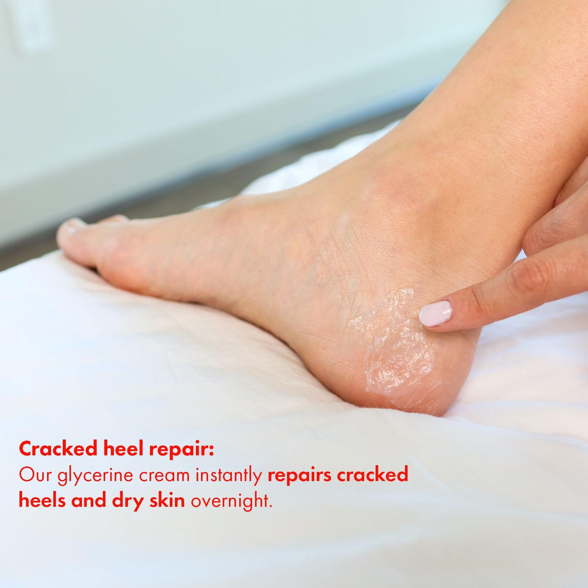 ELMORE overnight treatment image shows thicker layer on feet.