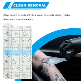 Emalla transparent aftercare patch: easy removal and monitoring of healing progress