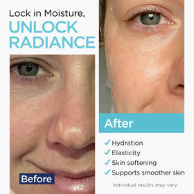Ember Cloud serum application scene highlights gentle hydration for lips and face.
