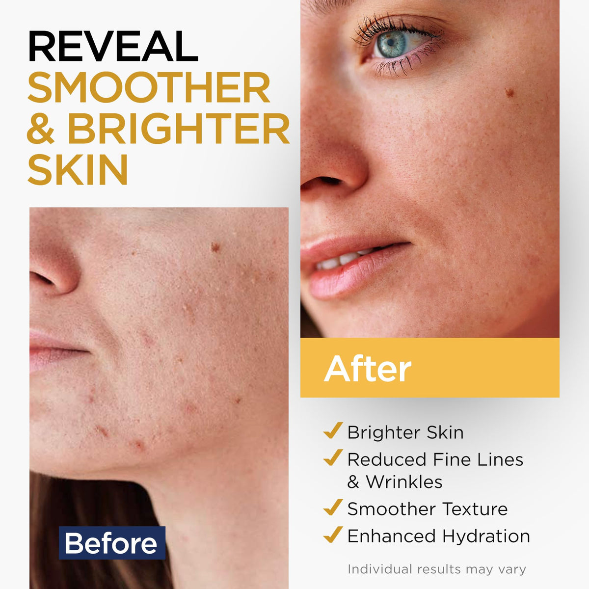 Thai product routine: Ember Cloud Vitamin C Serum being applied as part of morning skincare.
