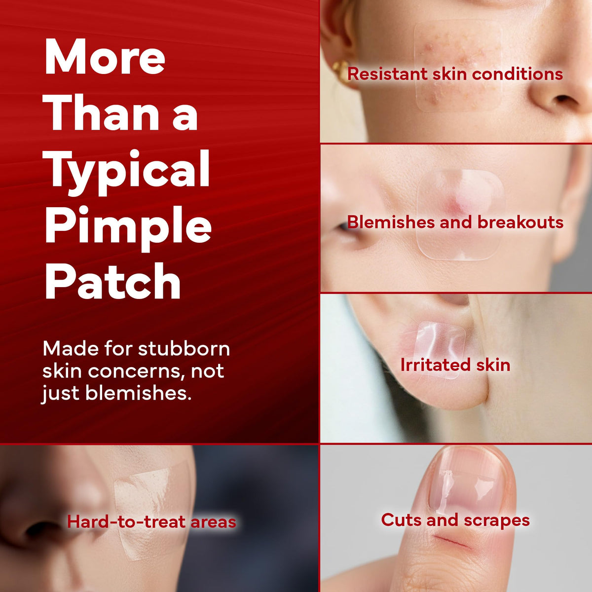 EMUAIDMAX hydrocolloid patches pack ready for travel