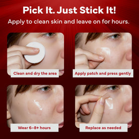 EMUAIDMAX patches applied to different blemishes for targeted support