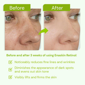 Texture close-up of Enaskin Naturals Retinol Serum: lightweight, fast-absorbing.
