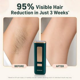 ENCHELYR IPL unlimited flashes eliminate cartridge replacements during sessions.