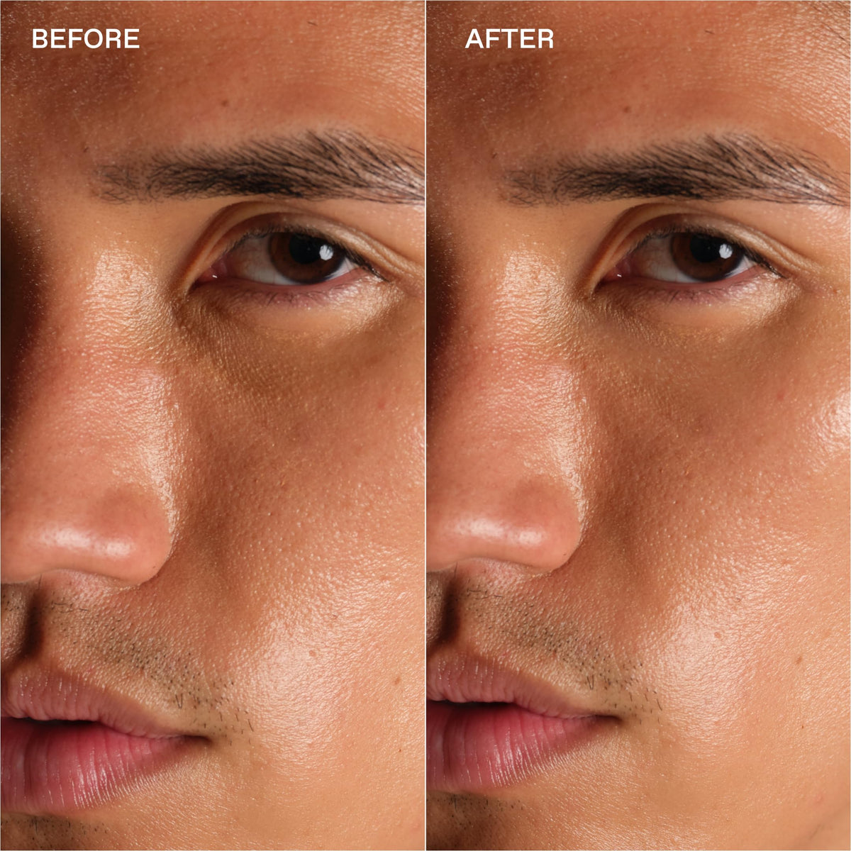 Enhanse Under Eye Gel bottle cap close-up highlights sleek design and secure travel-friendly top.