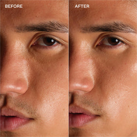 Enhanse Under Eye Gel bottle cap close-up highlights sleek design and secure travel-friendly top.