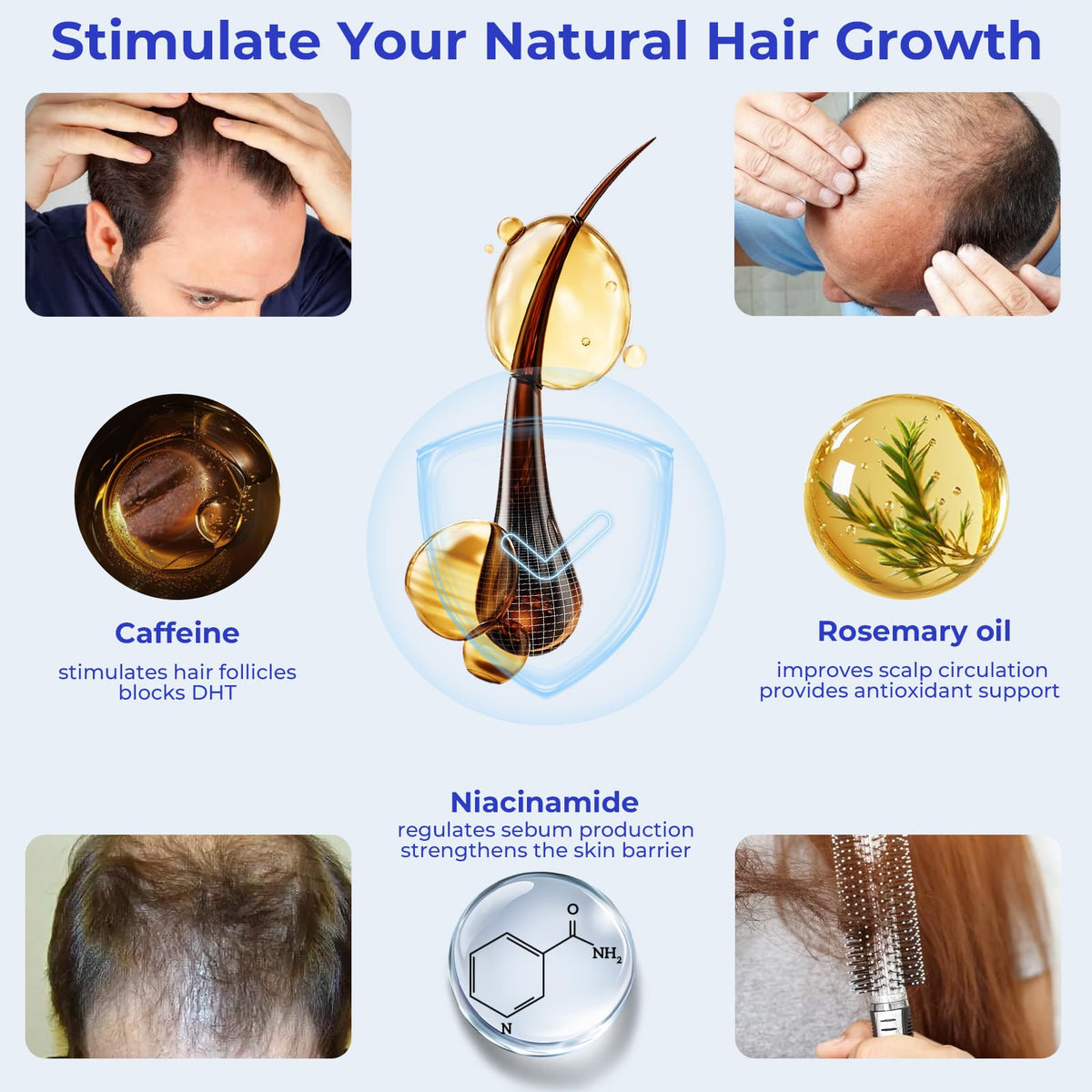 Eoiroa caffeine and niacinamide energize hair roots for healthier-looking strands.