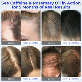 Eoiroa tea tree and lavender blend delivers a refreshed scalp feel.