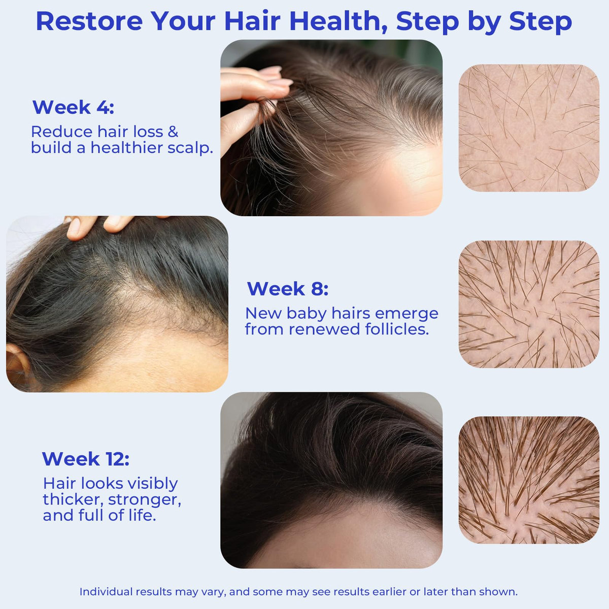 Eoiroa thinning-area coverage with precision roll-on for on-the-go use.